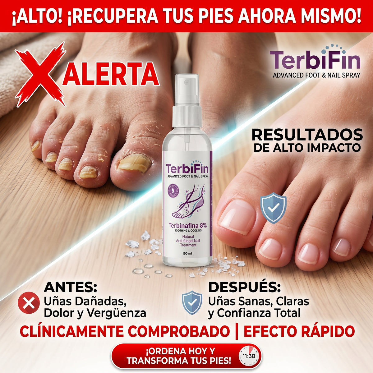 ¿Hongos, picazón y mal olor en tus pies? Terbifin, Spray Antihongos para Pies y Uñas — Alivio Rápido